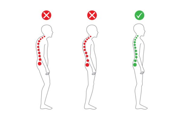 Postur Tubuh yang Baik, Penting Bagi Kesehatan (city-chiropractic.com)