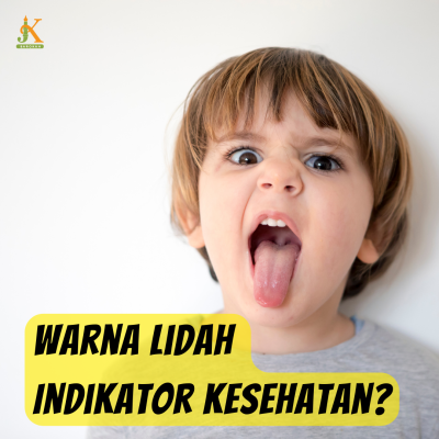 Warna Lidah Indikator Kesehatan